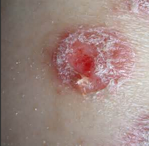 ��Ѣ�����Ʒ�������Щ