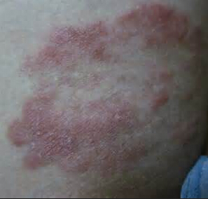 ���Ѣ������֢״����Щ