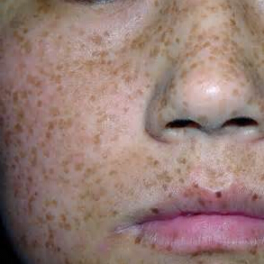 ȸ���γɵ�ԭ��