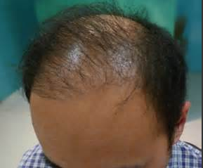 ����������ư�ͺ�ȽϺ�