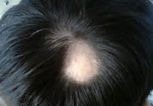 ��ͺ�γɵ�ԭ������Щ