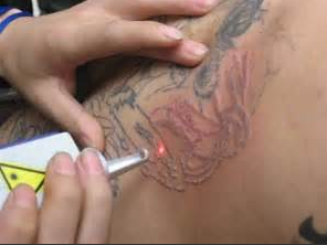 ���ϴ�����۲���