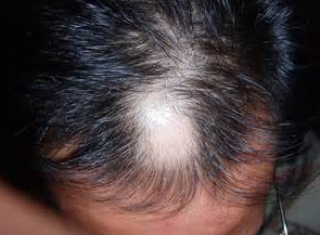 ���԰�ͺ��ԭ������Щ