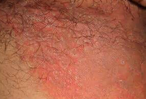 ���Ѣ������Ҫ��ʲô���