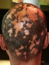 ����ΰ�ͺҪ������Ǯ