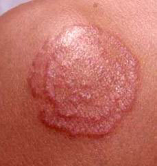 ���˹�Ѣ��ô��