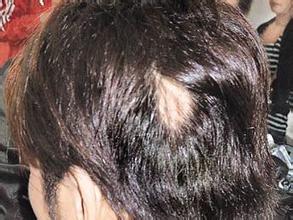 С����ͺ��ԭ������Щ