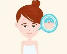 天津哪里治青春痘好